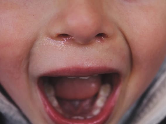 What Emotion Dysregulation Looks Like in Children
